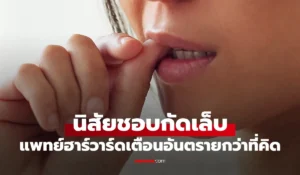 นิสัยชอบกัดเล็บ