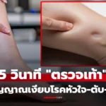 ตรวจเท้า 5 วินาที ช่วยชีวิตตัวเองได้ สัญญาณเงียบโรคหัวใจ
