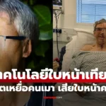 ใบหน้าเทียม  คืนชีวิตให้เหยื่อเมาแล้วขับ สูญเสียใบหน้า