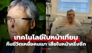 ใบหน้าเทียม 