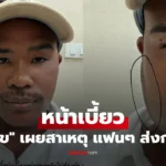 รัศมีแข เผยภาพหน้าเบี้ยว พร้อมสาเหตุที่ชัดเจน แฟนๆส่งกำลังใจ